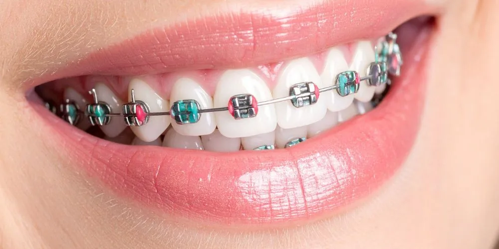 orthodontics